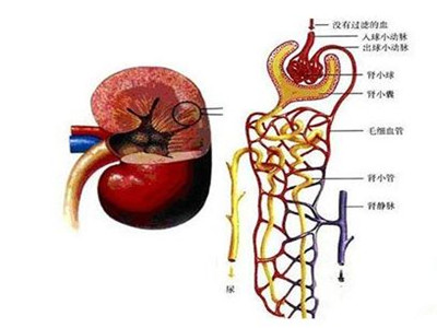 啥是IgA肾病，IgA肾病有哪些临床特点