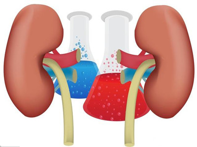 狼疮肾的3个治疗方案，可以稳住病情，拖住尿毒症