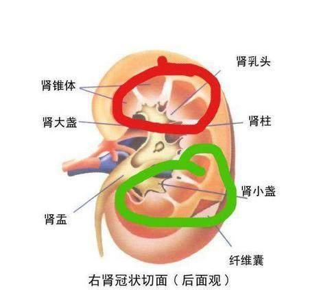 过敏引起的肾炎——过敏性紫癜性肾炎