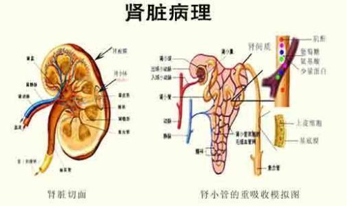 如果存在这些症状，警惕过敏性紫癜肾炎可能发生了！