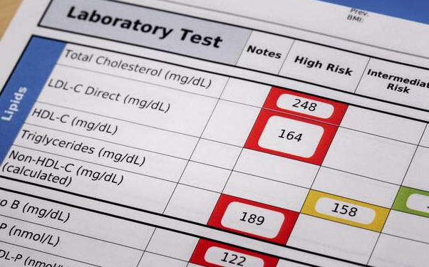 血脂检查